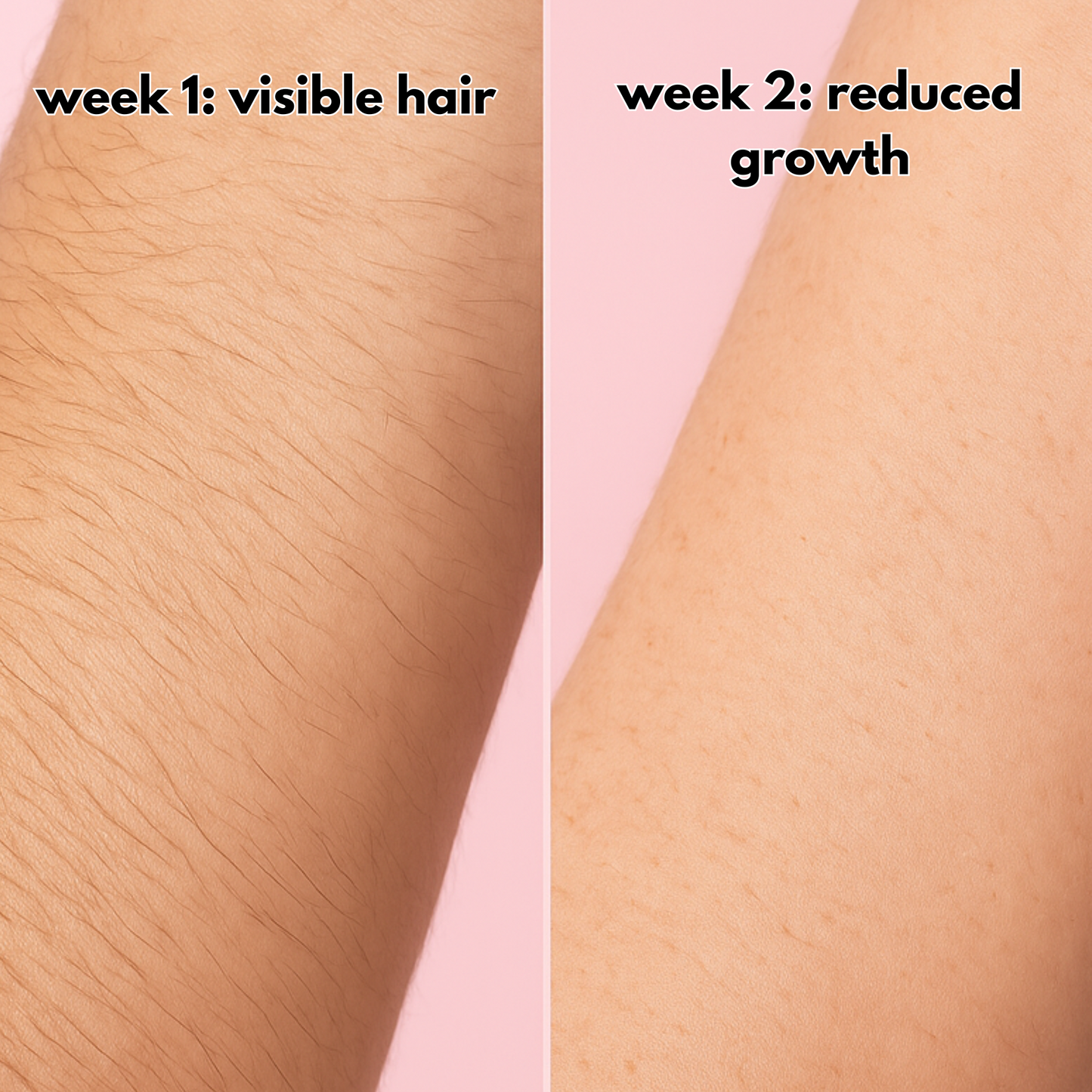 Kotae Glow Pro IPL™